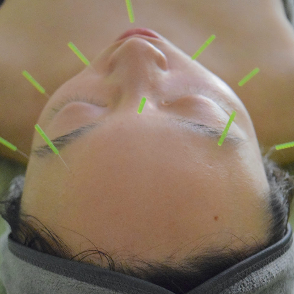 Wellness on Whyte - Facial